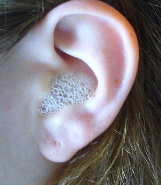ear-peroxide